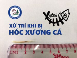 7 Bước cần làm khi trẻ em bị hóc xương cá và cách điều trị 7 Bước cần làm khi trẻ em bị hóc xương cá và cách điều trị