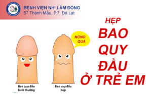 Hẹp Bao Quy đầu ở Trẻ Em